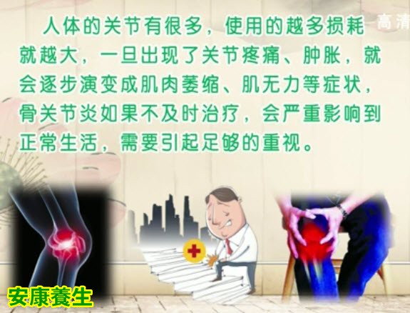 骨关节炎的表现