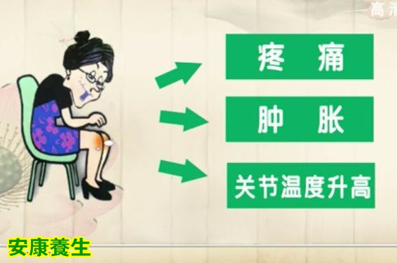 骨关节炎有一定的遗传性