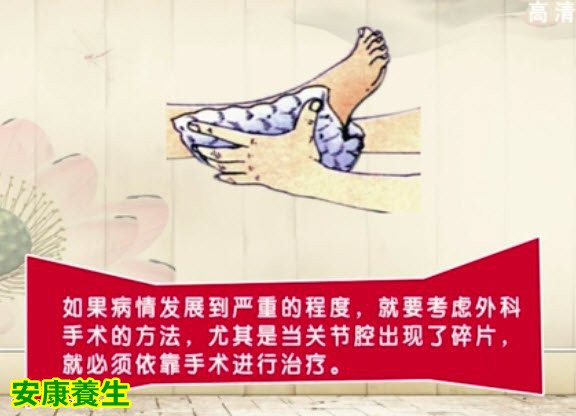 骨关节炎的预防