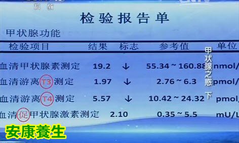 做抽血检查可以发现甲减