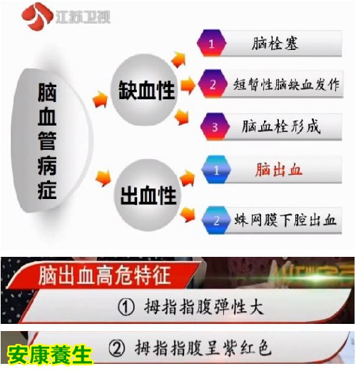 江苏卫视20140727万家灯火视频:高振宗讲掌握健康的密码Ⅱ,手护血管,预防中风小妙招
