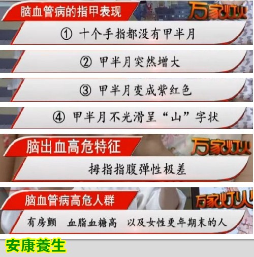 江苏卫视20140727万家灯火视频:高振宗讲掌握健康的密码Ⅱ,手护血管,预防中风小妙招