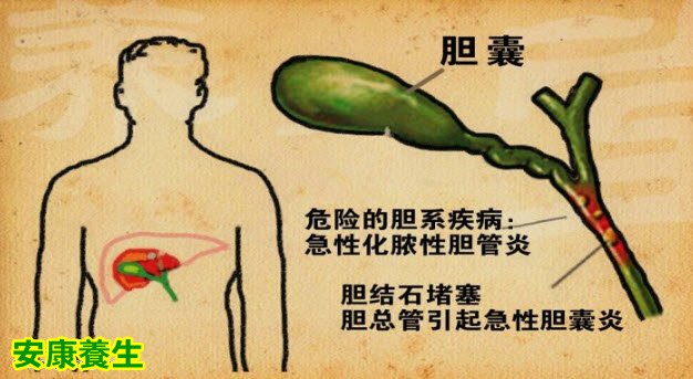 急性胆系疾病为什么危险