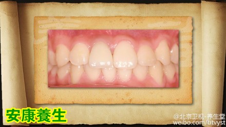 养生堂20150129视频和笔记: