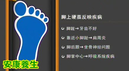 家政女皇20150323视频和笔记:拇外翻导致的疾病 脚趾有硬茧说明身体有什么问题
