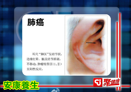 聚健康20150325视频和笔记:远离癌症怎么吃(8)