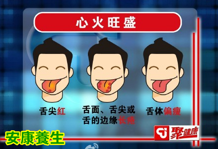 聚健康20150326视频和笔记:《远离癌症怎么吃(9)》