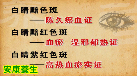 养生堂20150403视频和笔记:通过眼睛特征发现血瘀 瘀血药食两用调理