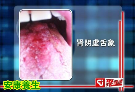 聚健康20150914: 冯兴华《祛邪有奇药-4》种子类药物的神奇功效