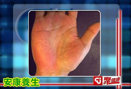 聚健康20150918: 裴学义《小儿王献长寿方-4》