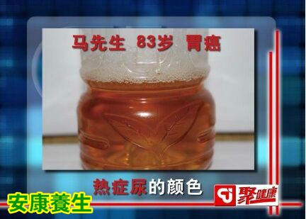 聚健康20151014:吉太加《神奇藏医药-3》看尿液泡沫知健康