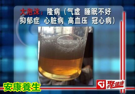 聚健康20151014:吉太加《神奇藏医药-3》看尿液泡沫知健康