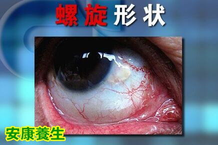 聚健康20151022:覃迅云《给身体做减法-4》