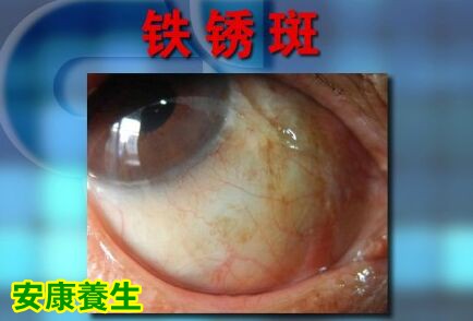 聚健康20151022:覃迅云《给身体做减法-4》