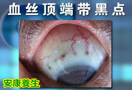 聚健康20151023:覃迅云《给身体做减法-5》
