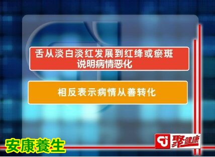 通过舌相看癌症状态