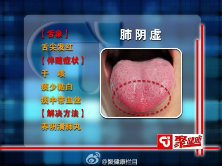 肺阴虚