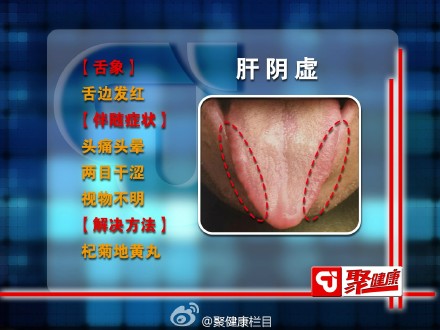 肝阴虚