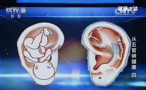 耳穴全息图