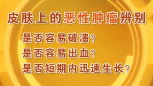 北京卫视20160205养生堂:《皮肤老化需防癌》皮肤癌、脂溢性角化症