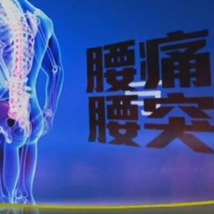 健康之路20160311视频笔记:朱宏伟讲《腰痛与腰突》腰椎间盘突出的表现