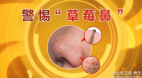 胃癌的四大症状