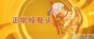 北京卫视20160323养生堂:骨头坏死的三大危险因素与防治措施