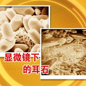北京卫视20160419养生堂:周立春、刘明勇、耳石症、眩晕、呕吐