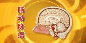北京卫视20160425养生堂:张鸿祺、脑动脉瘤、脑出血、出血性卒中、缺血性卒中