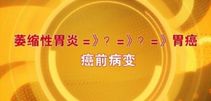 北京卫视20160523养生堂:肠化的症状、炎症性肠道疾病的饮食禁忌