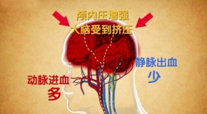 北京卫视20160723养生堂：吉训明、《纠缠不休的脑鸣》、耳鸣、静脉、叶酸