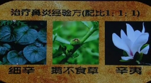 健康之路20160726视频和笔记:《中医妙招解鼻炎》哪种药物可缓解过敏性鼻炎？
