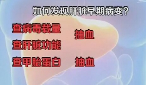 健康之路20160728视频笔记:乙肝丙肝的传播途径有哪些？哪种行为会导致肝脏病变