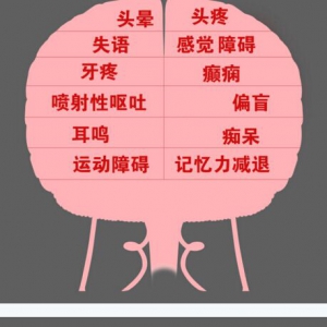 北京卫视20160802养生堂：脑瘤特有的症状、脑瘤的早期发现与预防