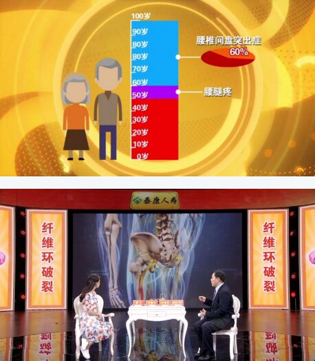 北京卫视20160808养生堂:海涌、《当心伤腰坏动作》、腰椎间盘突出、闪腰