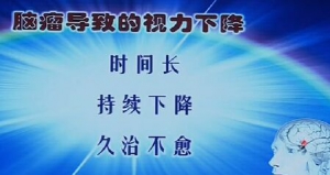 健康之路20160919视频笔记: 李世亭《意想不到的脑瘤信号》