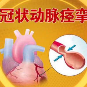 北京卫视20160925养生堂:如何保护心脏？冠状动脉痉挛、无症状型冠心病