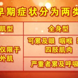 北京卫视20160929养生堂《当心！持续加重的乏力》重症肌无力