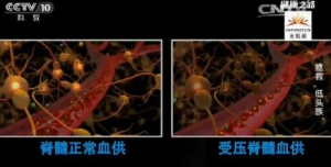 健康之路20161024：菅凤增《拯救低头族》颈椎保健操