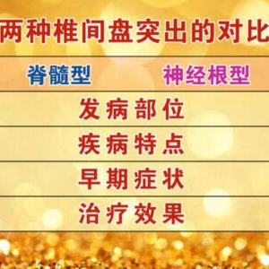 北京卫视20161028养生堂:《守护神经外“通道”》椎间盘突出、毛巾操