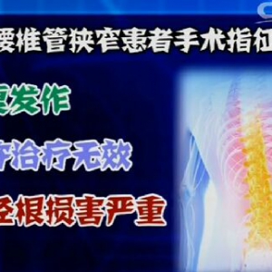 健康之路20161109《你的腰怎么了-下》椎管狭窄、间歇性跛行