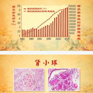 北京卫视20161112养生堂:刘玉宁、刘伟敬《关上肾脏损伤的大门》糖尿病肾病
