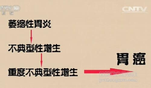 健康之路20170218毕晓峰《癌症测出来(上)》胸片与CT的区别