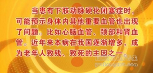 北京卫视20161124养生堂《餐桌上的血管“清道夫”》下肢动脉硬化闭塞症