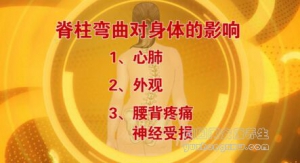 北京卫视20161130养生堂《南北名家话健康2-脊柱侧弯》王以朋、邱勇
