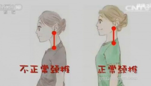 健康之路20161223《调脊柱保健康（上）》中药热敷、颈椎自我保健操