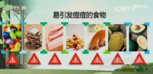 健康之路20170110王宝玺《大家一起来战“痘”（上）》油性皮肤
