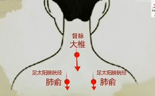 健康之路20170210王莹莹《手到病除(上)》刮痧