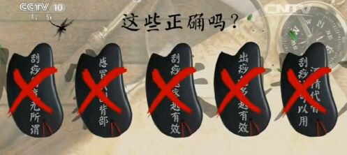 健康之路20170210王莹莹《手到病除(上)》刮痧
