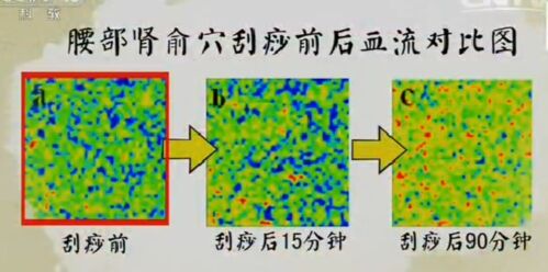 健康之路20170211王莹莹《手到病除(中)》颈痛、腰痛、腿麻
